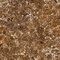 Керамогранит Artcer Brown Emperador POLI 120x60