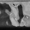 Керамогранит Neodom Levels Black Glossy 6x25 N100047-2